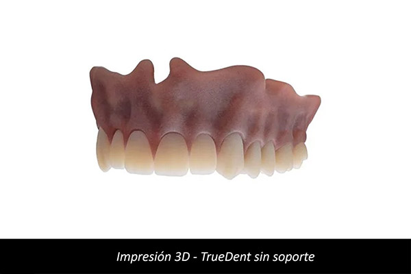 Impresión 3D Dental - TrueDent sin Soporte