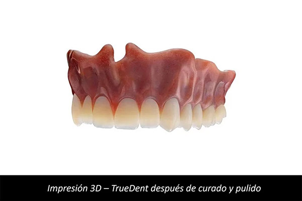 Impresión 3D Dental - TrueDent después de curado y pulido