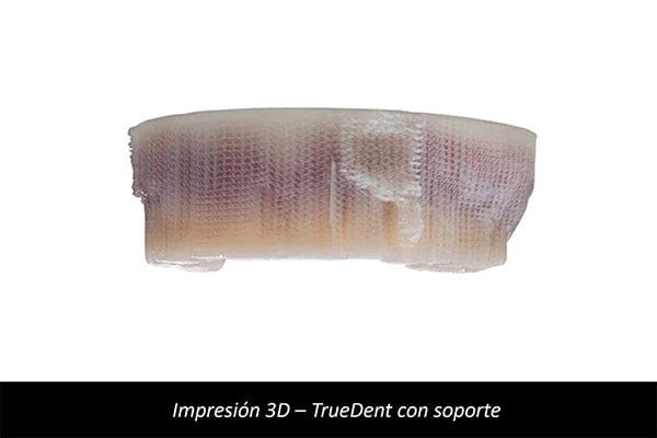 truedent-image-carrousel-1